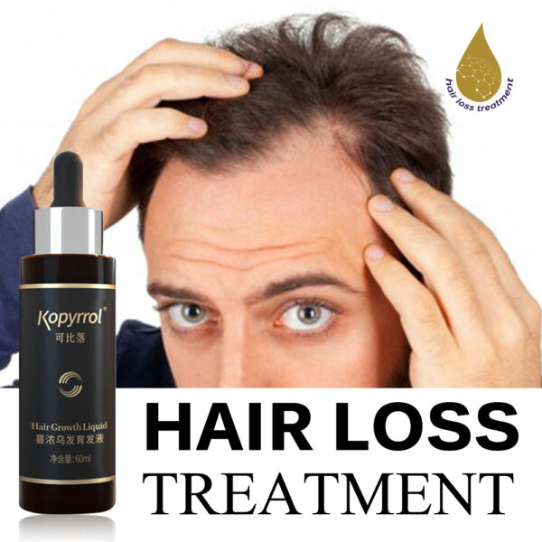 Hair Growth Essential Oil For Men/Women Anti-Hair Loss Serum Healthy & Safe Hair Care Treatments Effective Hair Regrowth Product - Image 2